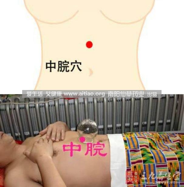 中脘穴位于腹部正中線，臍上4寸的位置上。每天艾灸10-15分鐘，能有效緩解胃部不適的癥狀，同時有助于祛濕。